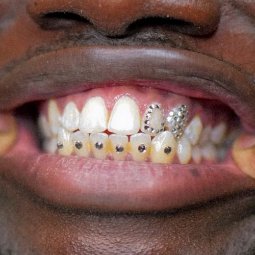 Dealeuse de gems - Grillz & Strass dentaire - Institut de beauté Rennes - Dealeuse de gems - Grillz & Strass dentaire - Photo Galerie - OneBooking