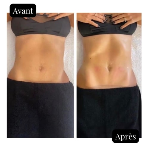 Maison de Jouvence - Manon Greuez - Naturopathe - Facialiste - Institut de beauté Arras - Maison de Jouvence - Manon Greuez - Naturopathe - Facialiste - Photo Galerie - OneBooking
