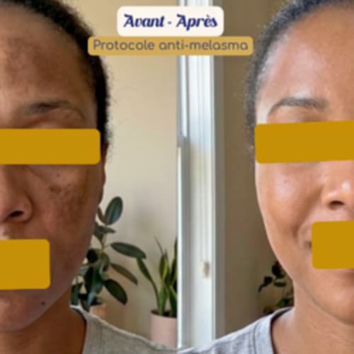 Melaskinxcare - Skin thérapeute & Esthéticienne experte peaux noires - Sourcils & cils Villejuif - Melaskinxcare - Skin thérapeute & Esthéticienne experte peaux noires - Photo Galerie - OneBooking