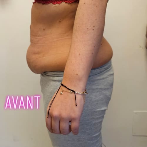 Carole Lipocavitation - Sourcils & cils Bourges - Carole Lipocavitation - Photo Galerie - OneBooking