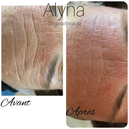 Alyna (Microneedling...) - Onglerie Toulon - Alyna (Microneedling...) - Photo Galerie - OneBooking