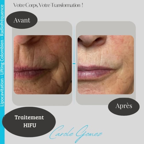 Carole Lipocavitation - Sourcils & cils Bourges - Carole Lipocavitation - Photo Galerie - OneBooking