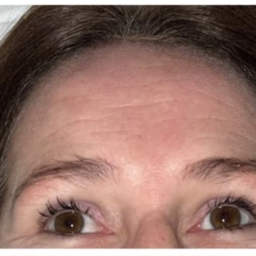 Beauty Lady'S - lifting colombien, lifting coréen, drainage lymphatique, Yumi Lash - Institut de beauté Nîmes - Beauty Lady'S - lifting colombien, lifting coréen, drainage lymphatique, Yumi Lash - Photo Galerie - OneBooking