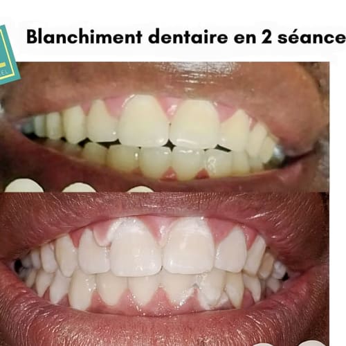 Kenze Naturel Piercing et Beauté - Onglerie Tours - Kenze Naturel Piercing et Beauté - Photo Galerie - OneBooking