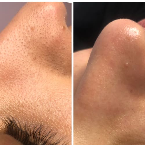 B-Otyskin Skincare - Sourcils & cils Ivry-sur-Seine - B-Otyskin Skincare - Photo Galerie - OneBooking