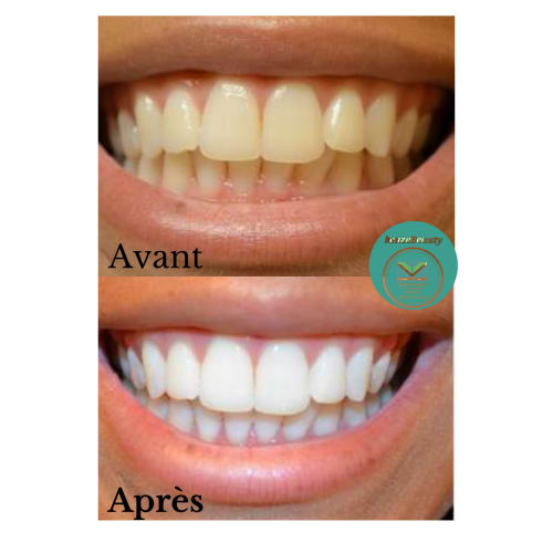 Kenze Naturel Piercing et Beauté - Onglerie Tours - Kenze Naturel Piercing et Beauté - Photo Galerie - OneBooking