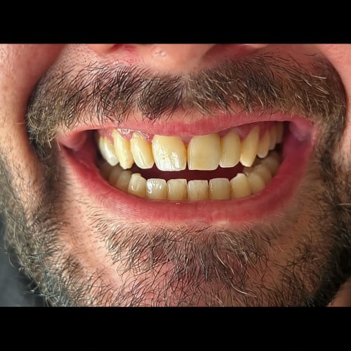 Smile Edit & Nailys Beauty - Onglerie Villefranche-sur-Saône - Smile Edit & Nailys Beauty - Photo Galerie - OneBooking