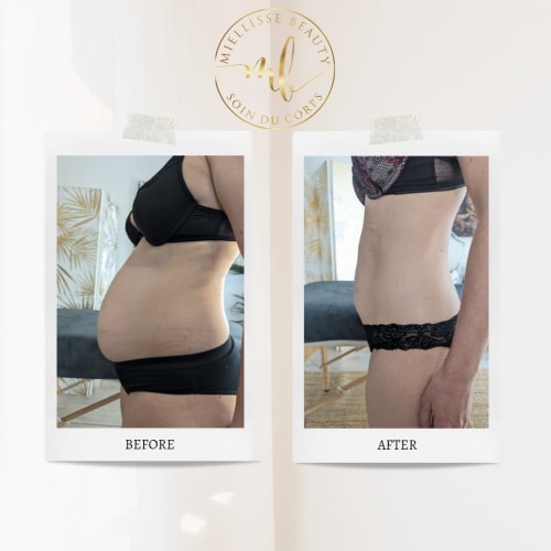 Miellisse Beauty - Onglerie Neuilly-sur-Marne - Miellisse Beauty - Photo Galerie - OneBooking