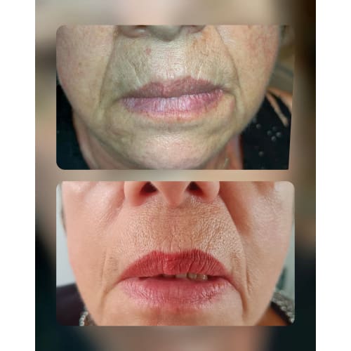 Studio Beauty & Brow - Épilation Laser - Institut de beauté Montpellier - Studio Beauty & Brow - Épilation Laser - Photo Galerie - OneBooking