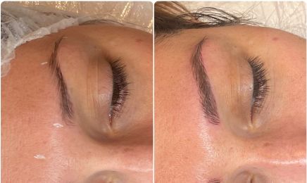 Fabrikaderm : Institut de beauté à Albi