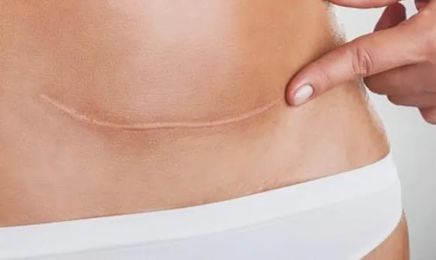 New Jeunesse Beauté : Institut de beauté à SAINT-MARTIN