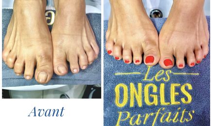 Les Ongles Parfaits : Manucure à Sète