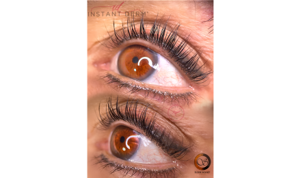 Instant Derm’ : Institut de beauté à Villemandeur
