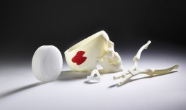Additive Fertigung in der Medizintechnik