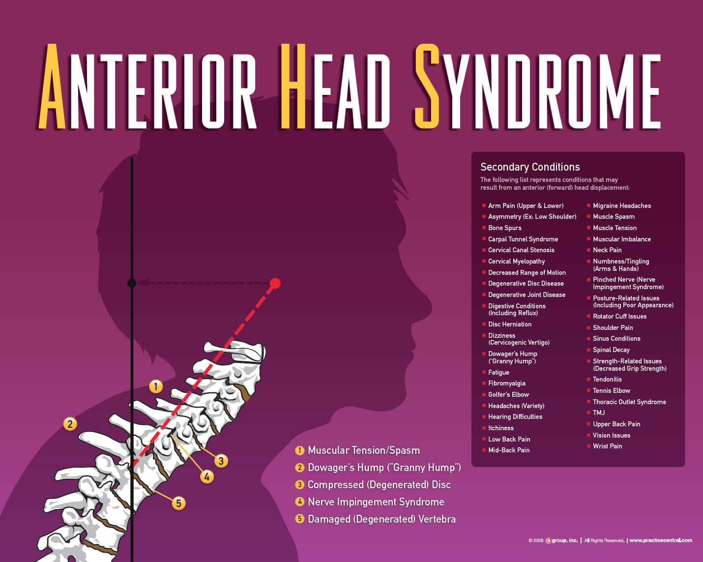 The most convenient treatment is to ingest a drug that will fool the body into not feeling its own cry for help. It’s convenient, fast and cheap. But it ignores the underlying cause, which, more often than not, is a Neuro-Structural shift putting pressure on the nerves and muscles of the neck.