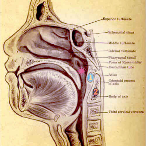 Ear Infections, Vertigo, Balance Issues Platinum Chiropractic