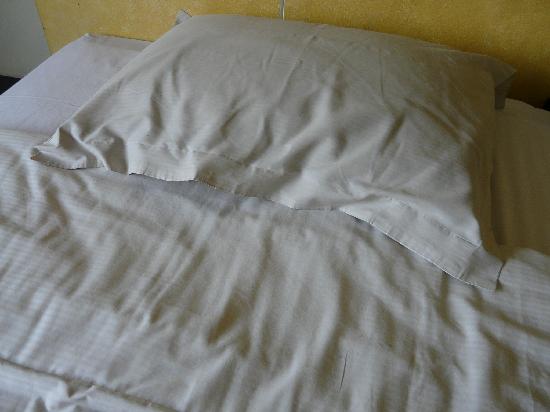 Sarung Bantal Bisa penyebab Tumbuhnya Jerawat Sarung Bantal Bisa penyebab Tumbuhnya Jerawat