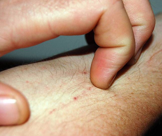 Clean your Pillows from Dust Mites
