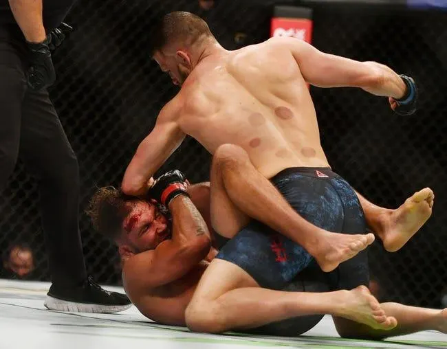 Josh Emmett vs Calvin Kattar 6/18/22 - UFC Picks & Predictions