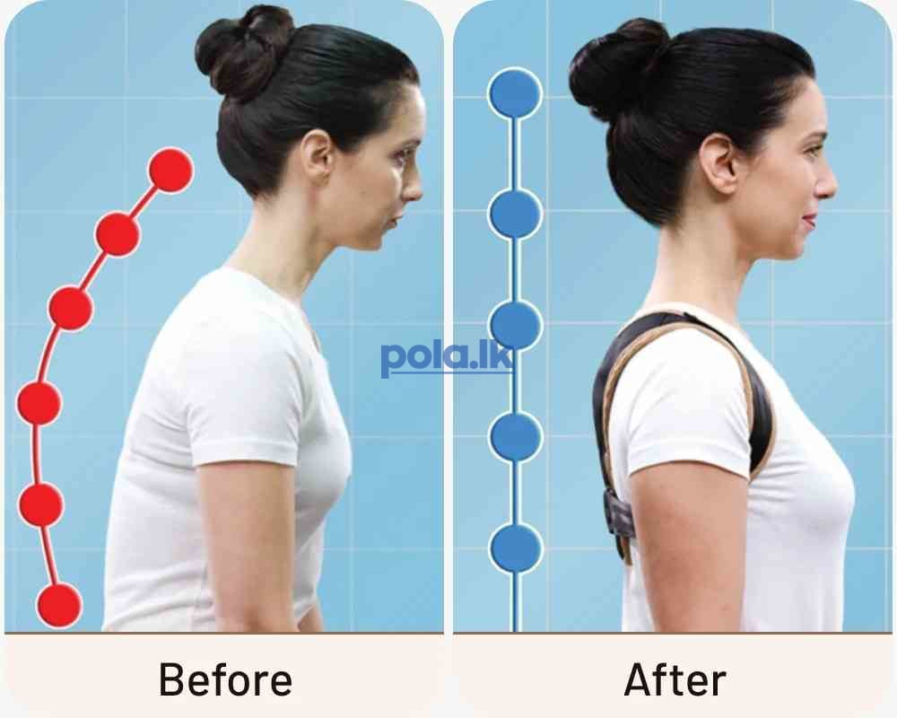 Doctor posture corrector support - photo 2