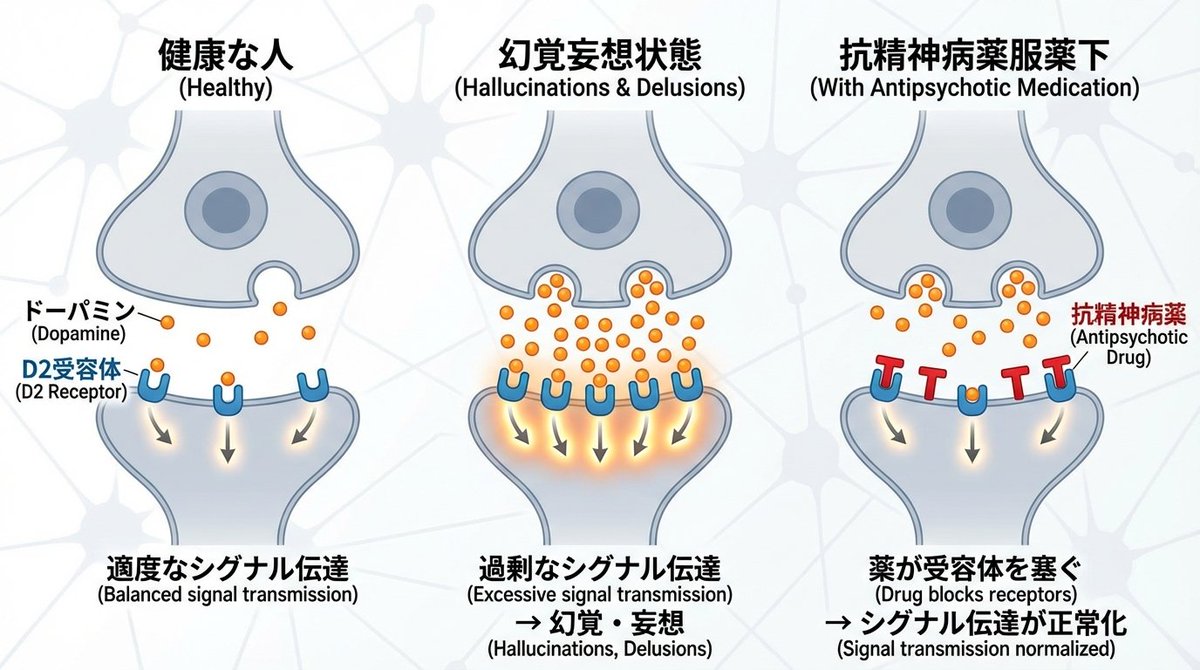 Dopamine and schizophrenia synapse diagram AI image template preview