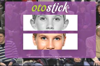 Otostick, la solución para orejas anchas