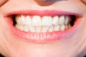 como tener los dientes mas blanco en un dia