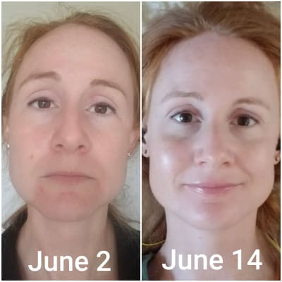 Skin Perfecting 2 Bha Liquid Exfoliant Paula S Choice