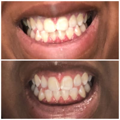 Colgate Optic White Whitening Toothpaste Sparkling White 4 Pk