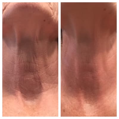 Retinol Skin Smoothing Body Treatment Paula S Choice