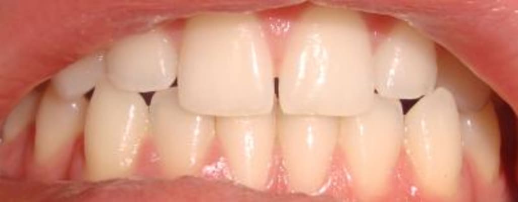 Crest 3d White Radiant Mint Whitening Toothpaste 5 Pk 5 4 Oz Bjs Wholesale Club