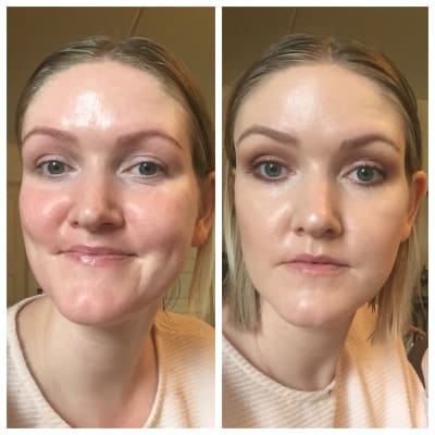 Clinical 1 Retinol Solution Treatment Paula S Choice