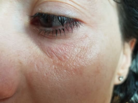 cosrx korean skincare