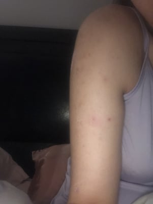 paula's choice aha lotion