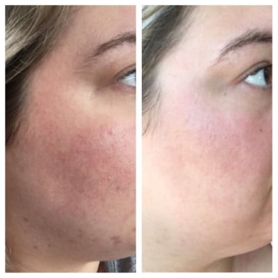 2 bha liquid exfoliant paula's choice