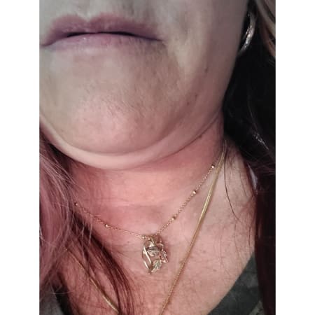 Customer image 1