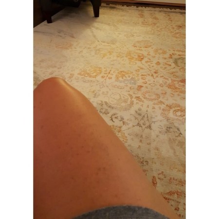Customer image 11