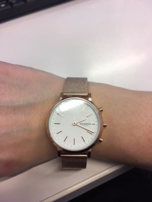 skagen mini hald review