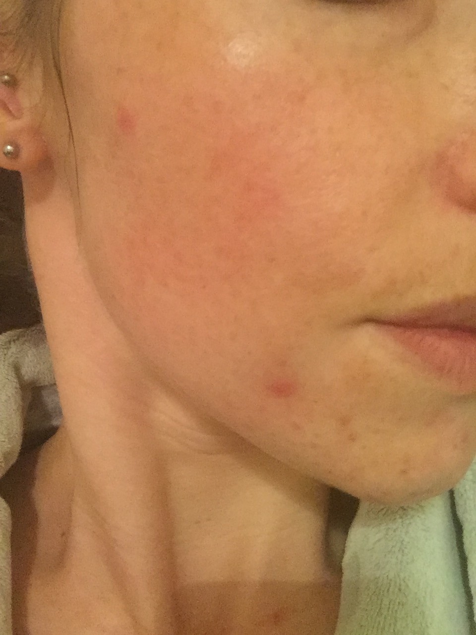 Customer carousel item 2.