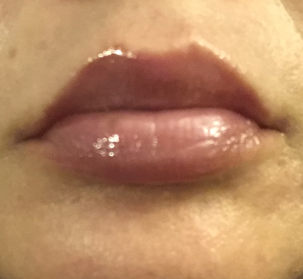 Customer carousel item 11.