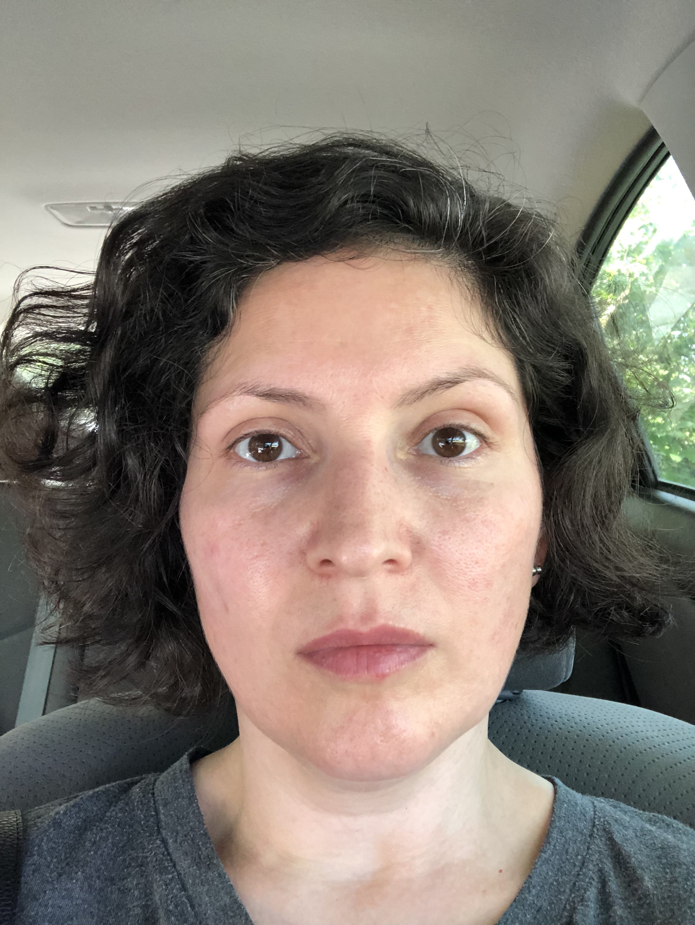 Freshly washed and moisturized face.