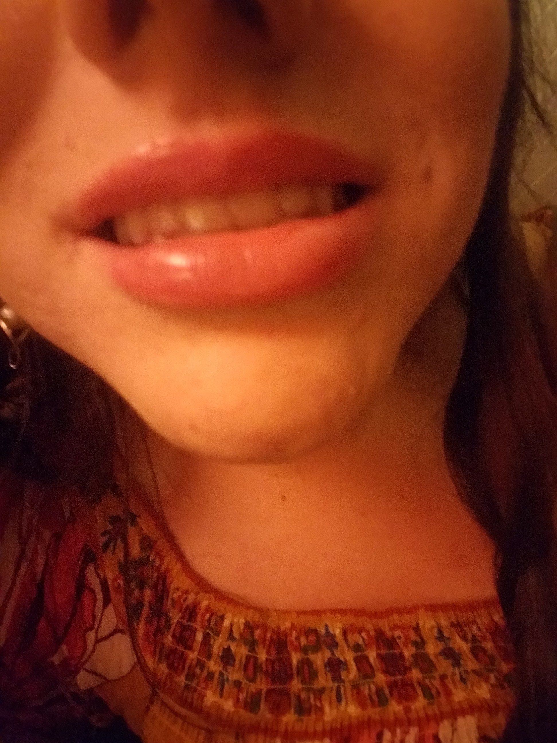 My upper lip looks much bigger!