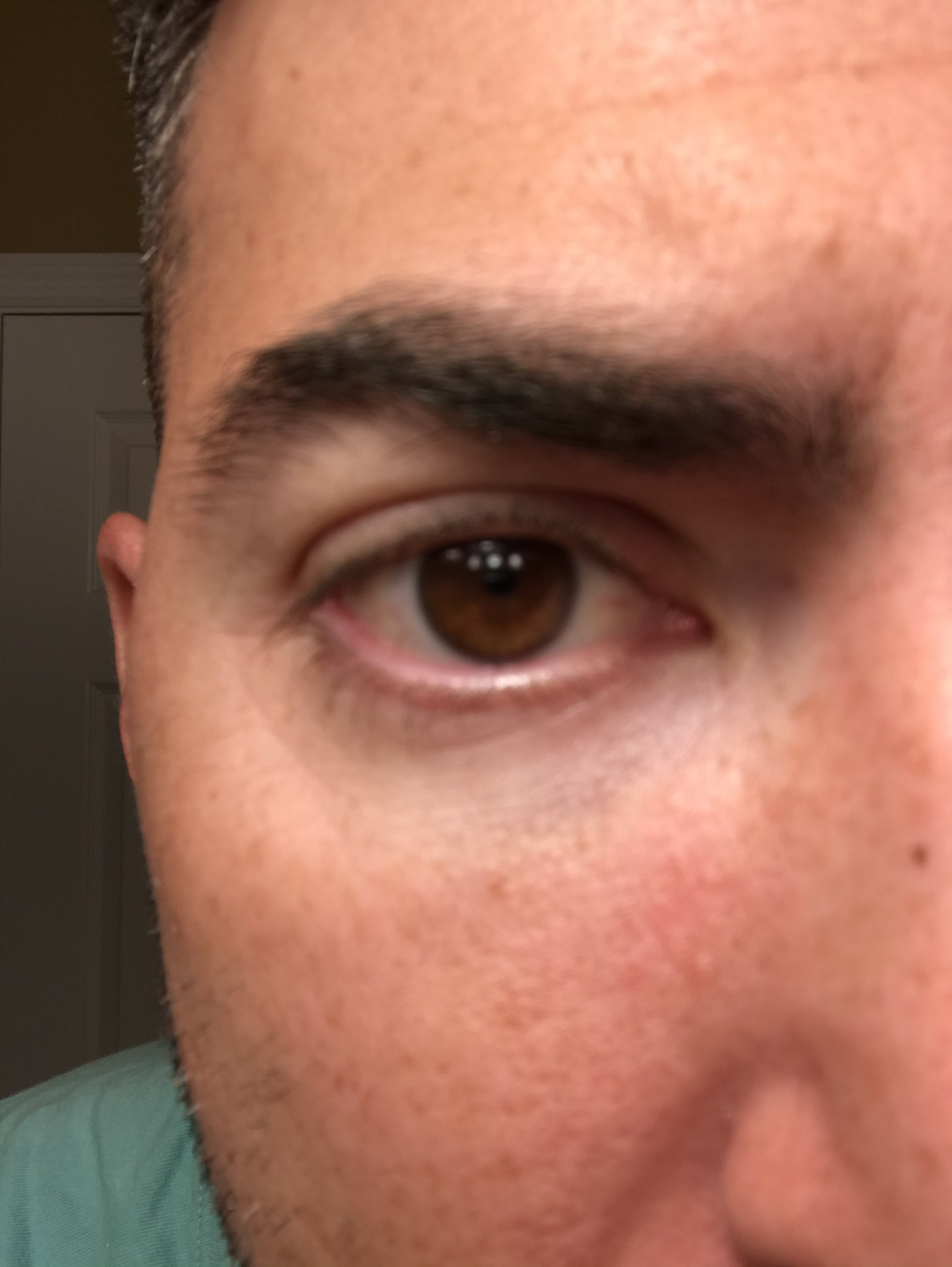 eye before