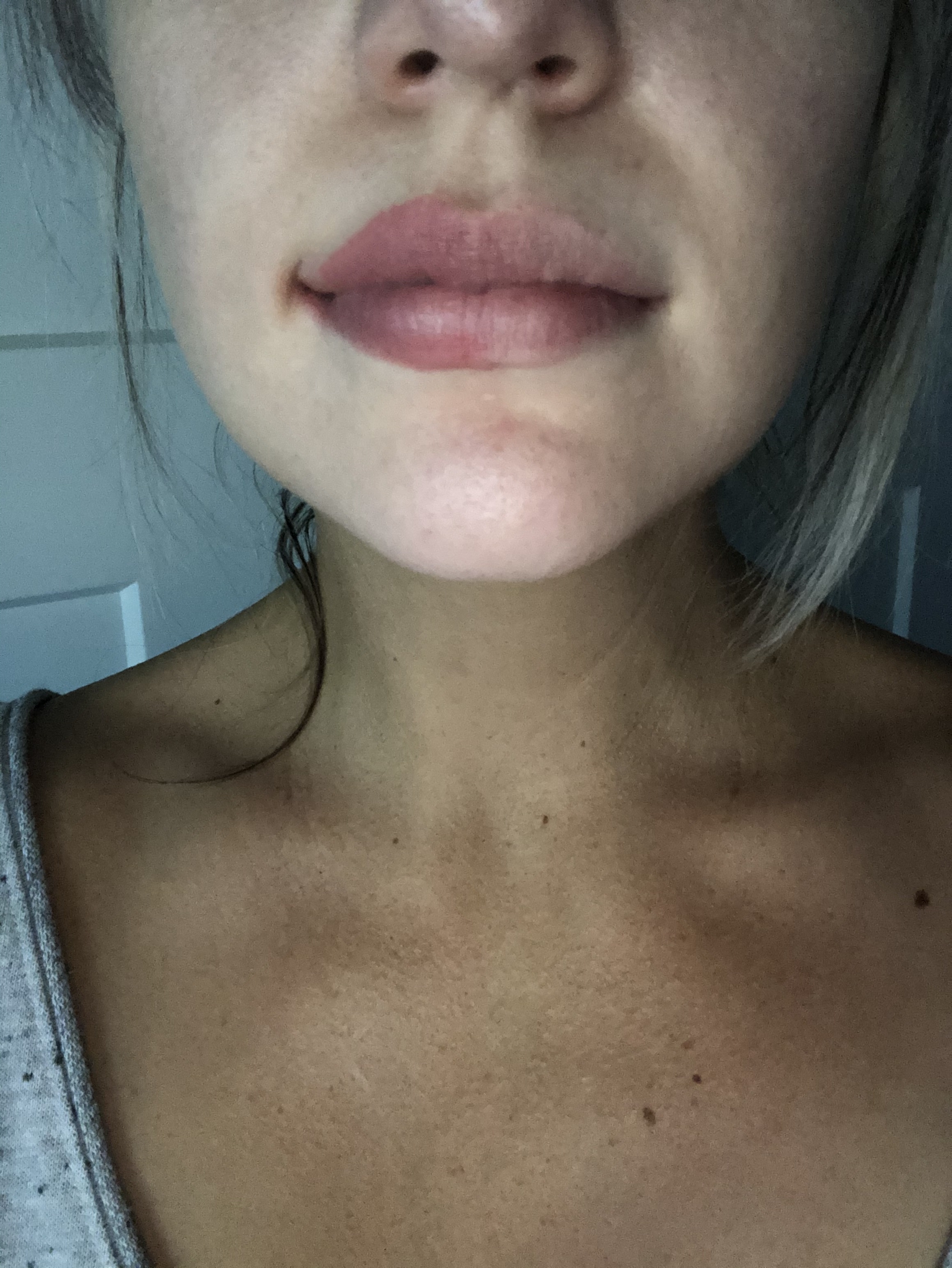 Just applied to one side to see the difference. Left it on for a bit and wiped it off and viola!💋😘