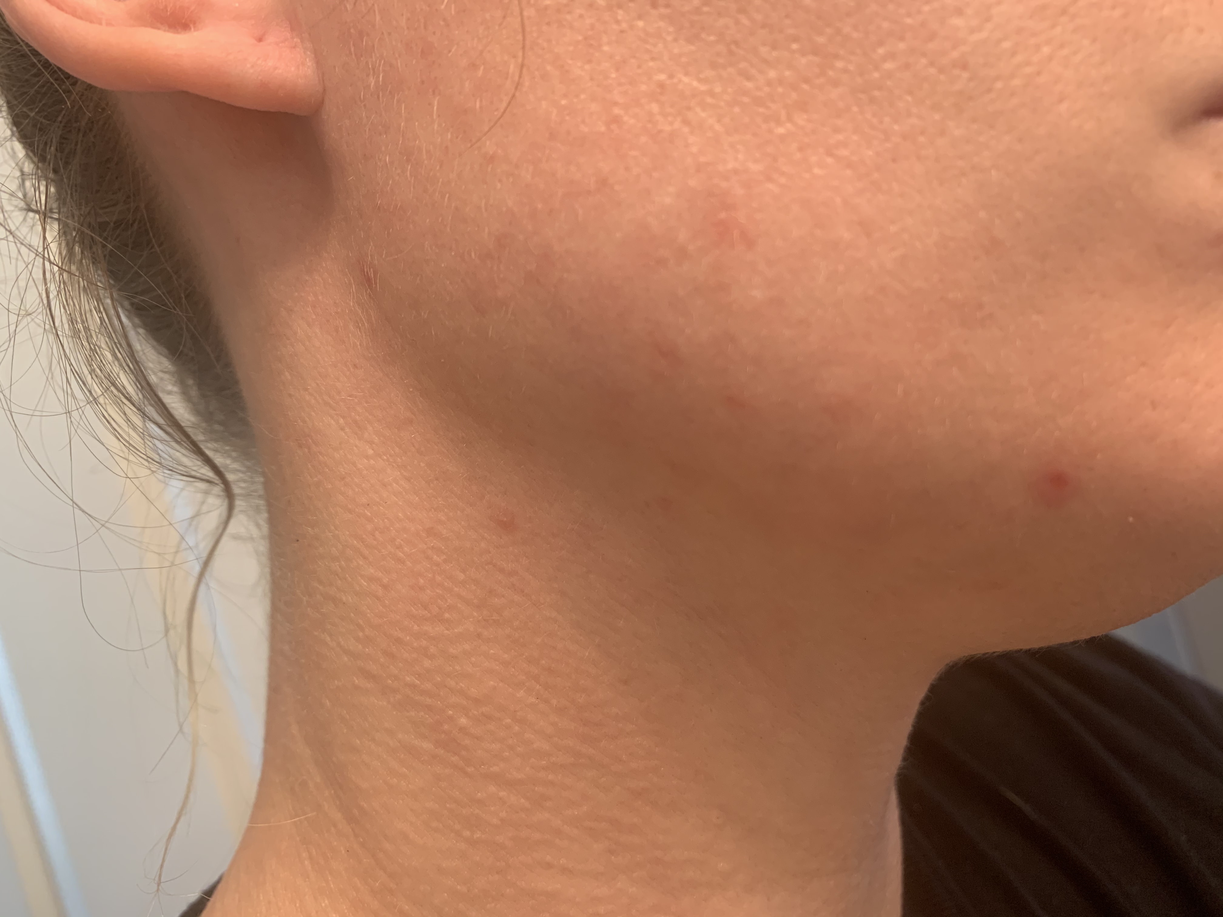 Day 3. Visible results!!! Yay.