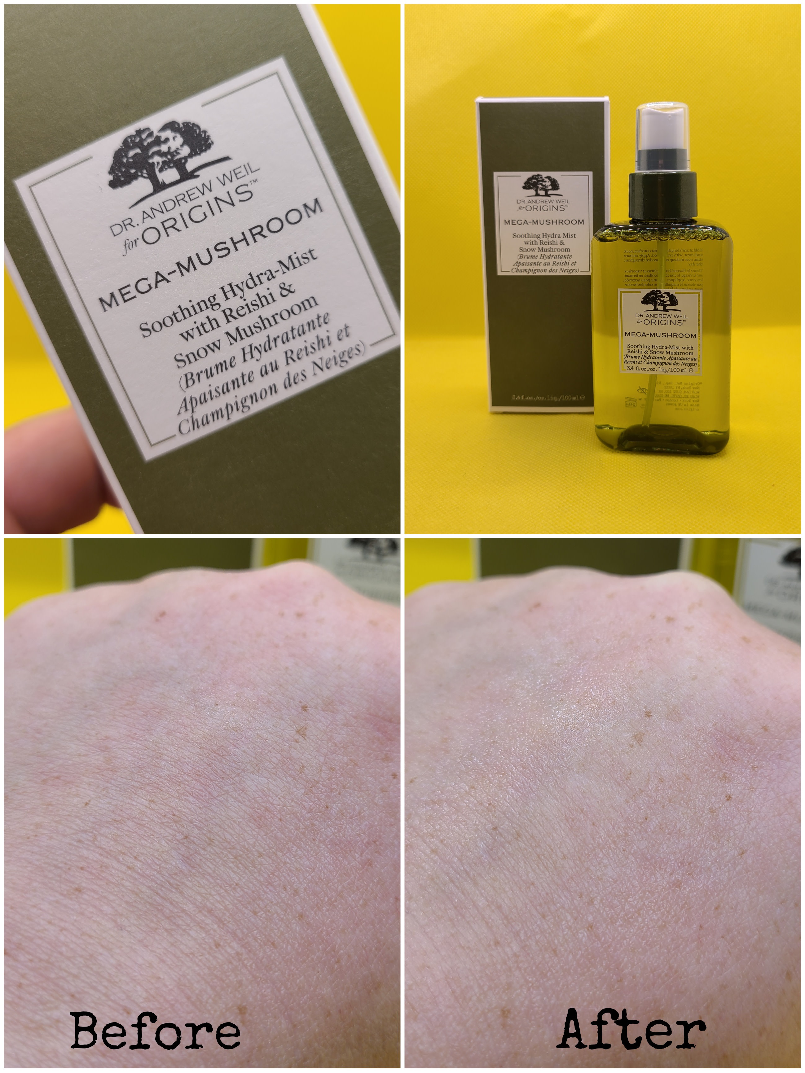 Reduces Redness (noticeably) with before & after photos