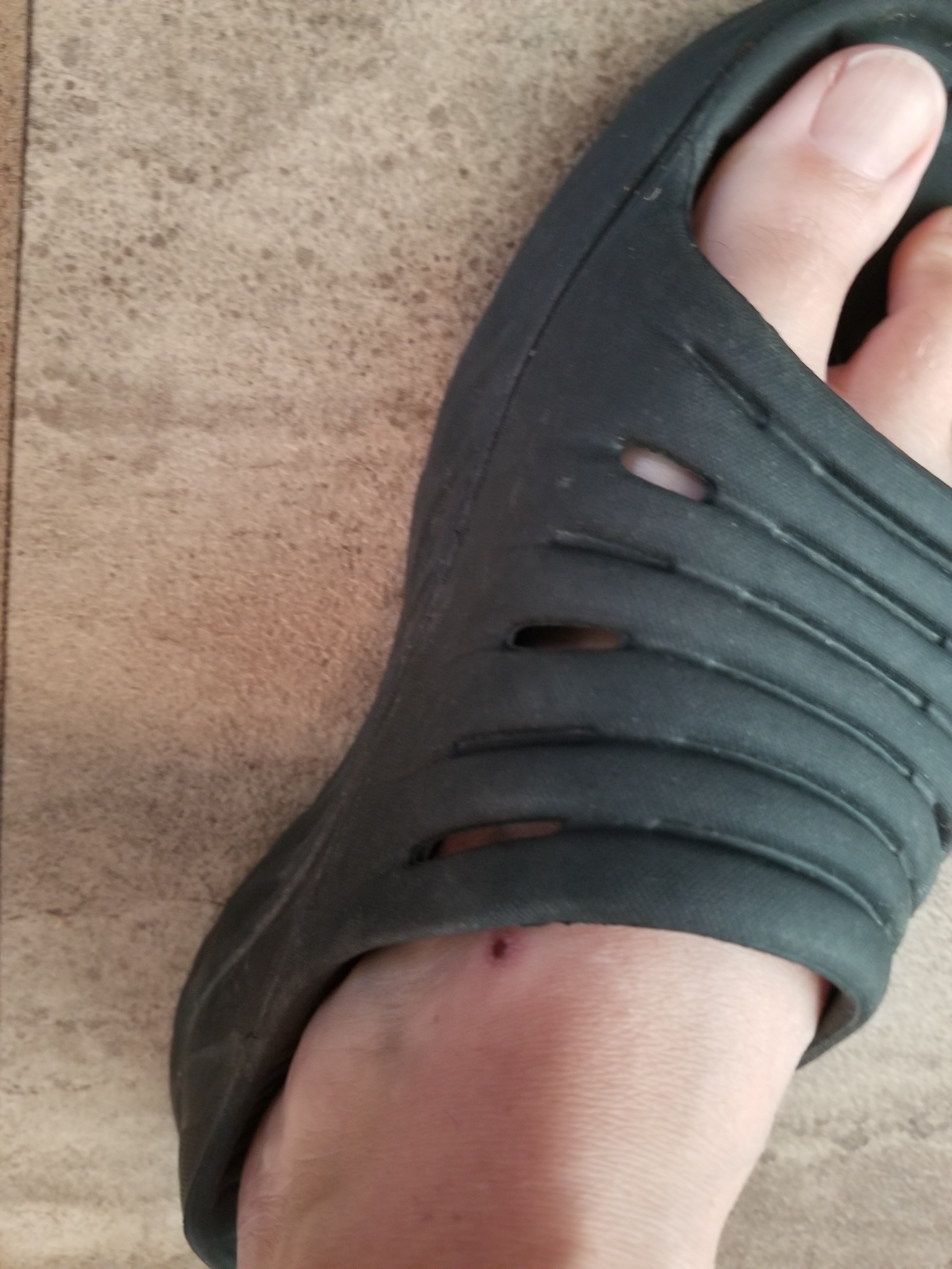 Not sure yet? Breaking in issue or a problem?