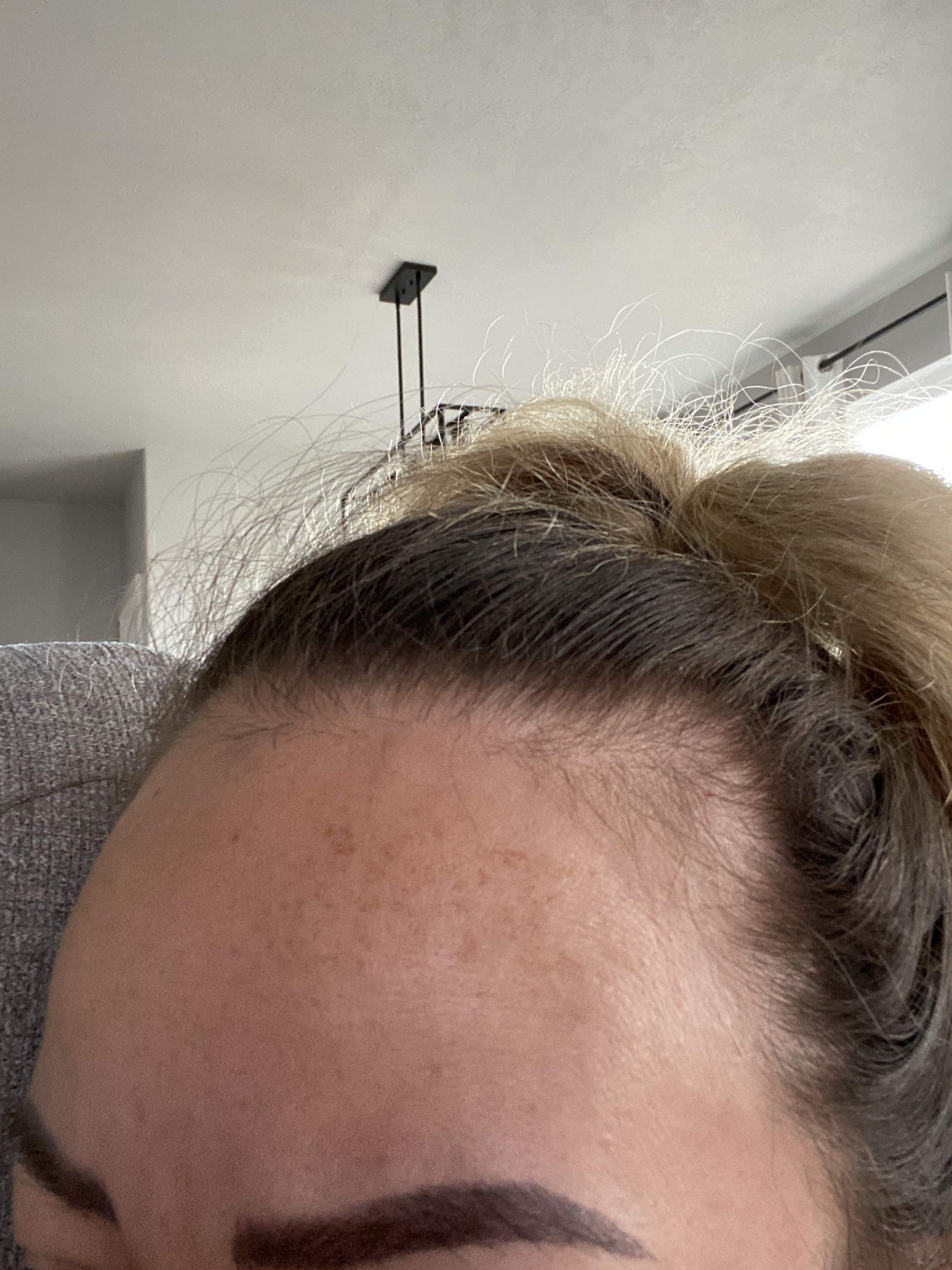 Its been months still no results i use it as with sunblock