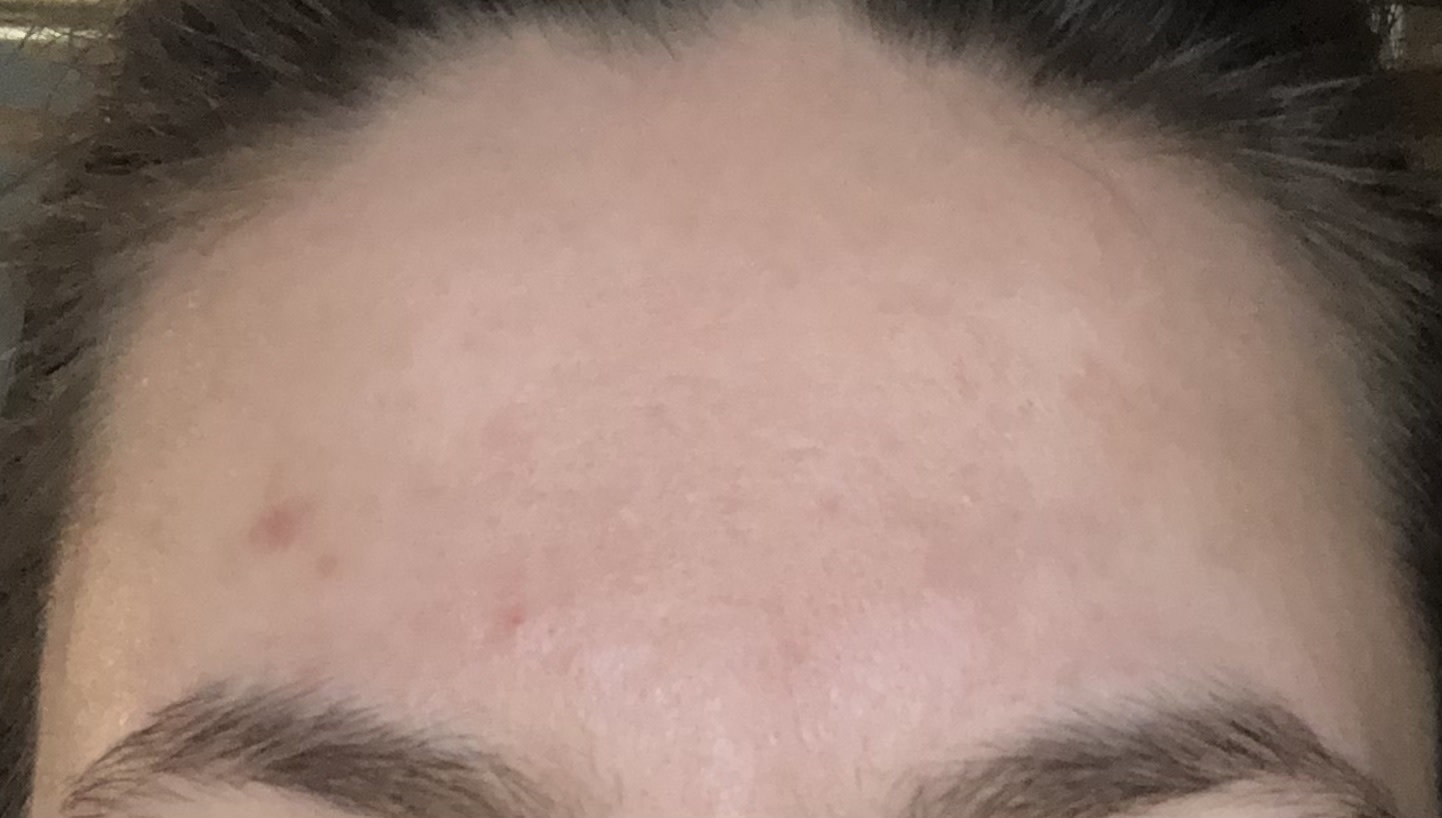 After (no makeup)