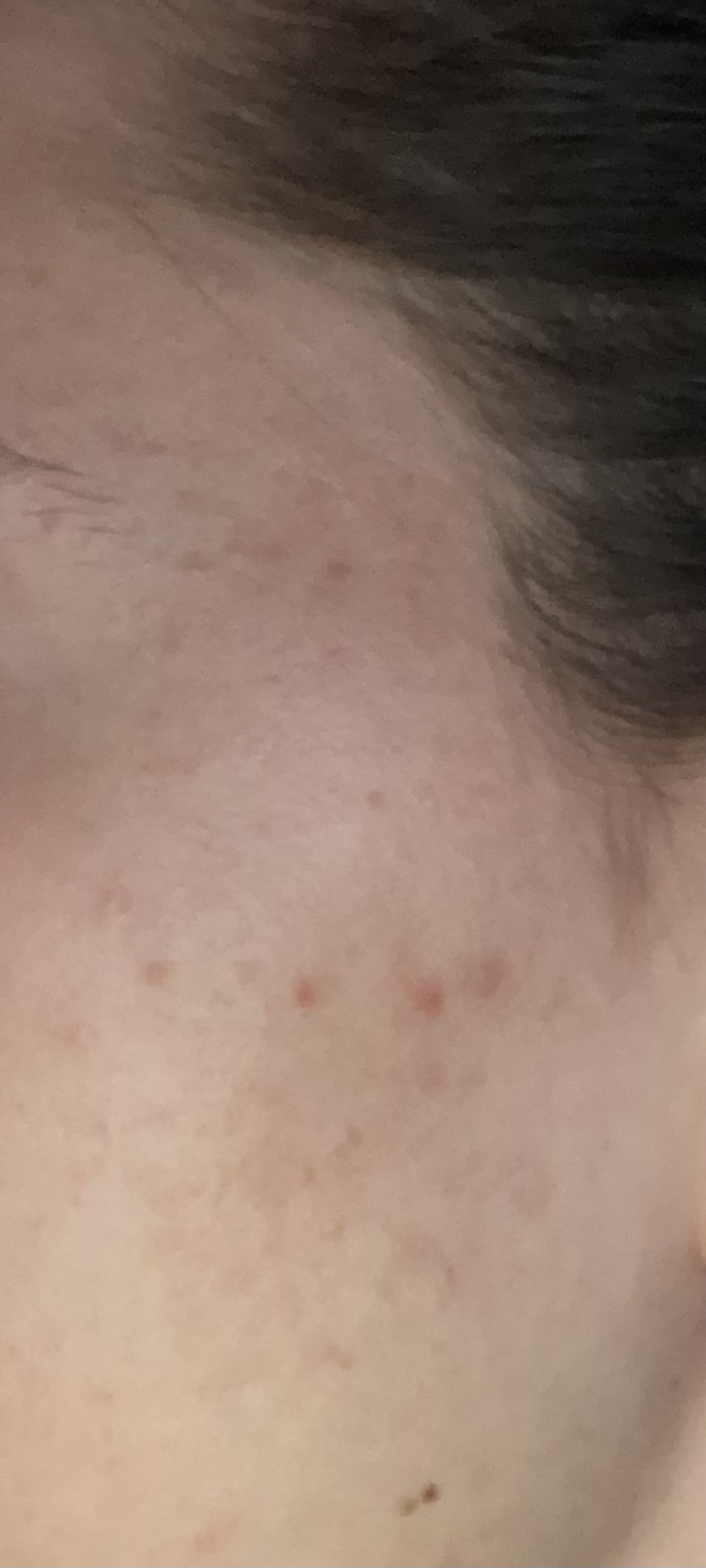 After (no makeup)
